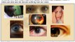 Retinal Specialists in Arizona Trivia Time - Arizona Retinal Specialists