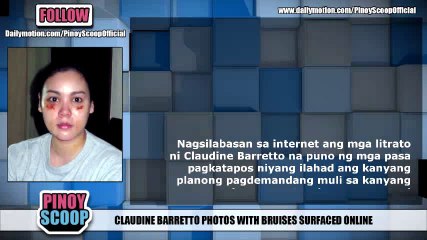 Claudine Barretto Photos With Bruises Surfaced Online