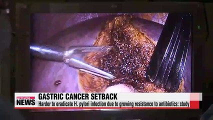 Harder to prevent gastric cancer from growing resistance to antibiotics