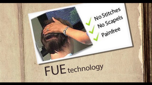 FUE hair transplant expert in pakistan,FUE vs FUT pakistan,FUE in Pakistan
