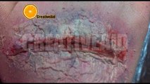 بطريقة سهلة وسريعة تعلم كيف تتم صناعة الجروح والحروق في السينماHow to Make a Fake Wound