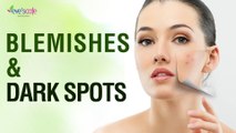 Natural Remedy for Blemishes and Dark Spots - Normal Skin