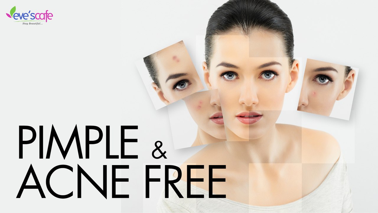 Natural Way to Cure Pimple and Acne