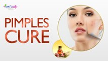 Cure Pimples and Cystic Acnes Naturally at Home