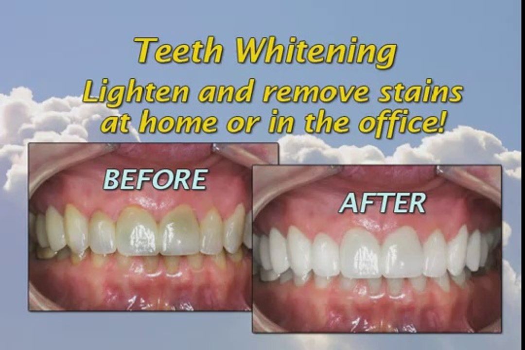 Dr. Steven W. Haywood Advanced Cosmetic & Restorative Dentistry