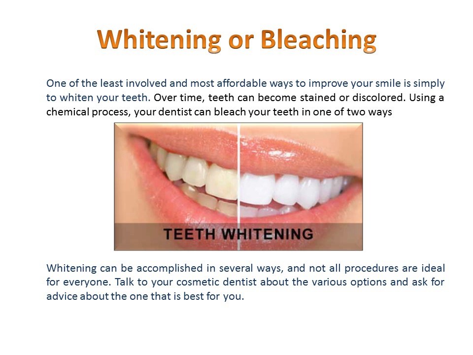 Cosmetic Dentistry Procedures provided by AFAM Dental in Brooklyn