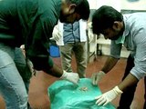 232 лишних зуба обнаружили во рту у подростка в Индии