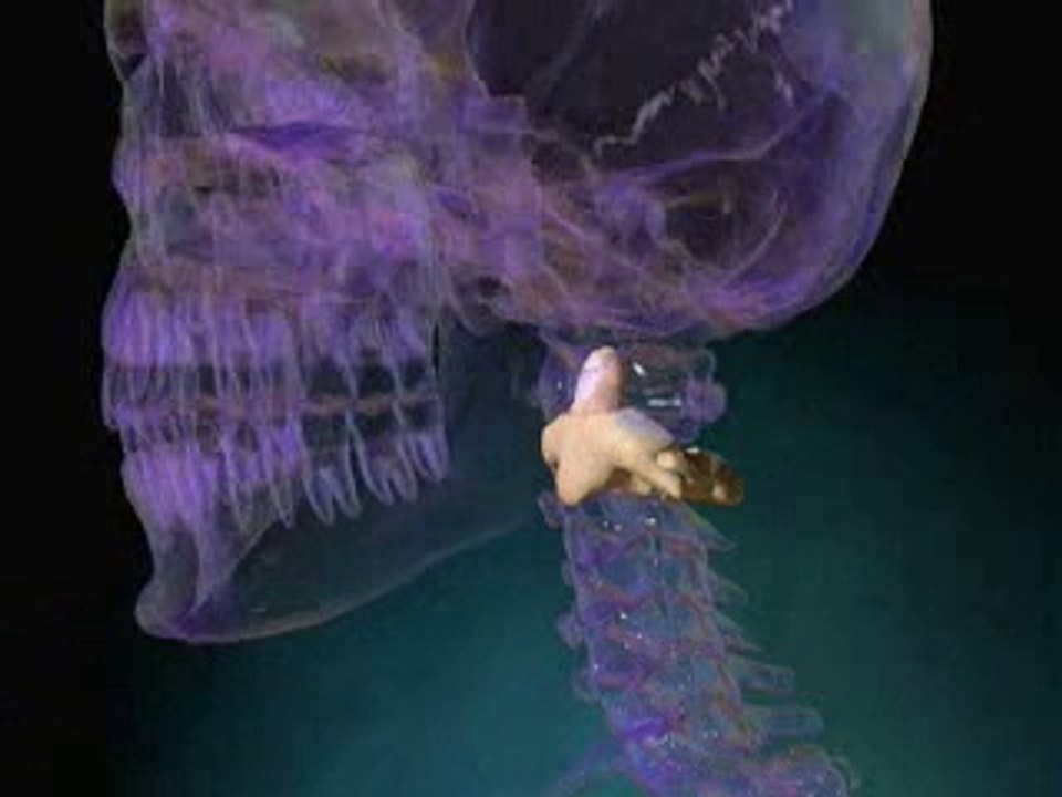 Cervical Spinal Stenosis Treatment _SpinalStenosis