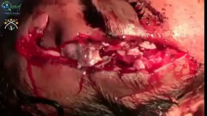 see how israel kills innocent people