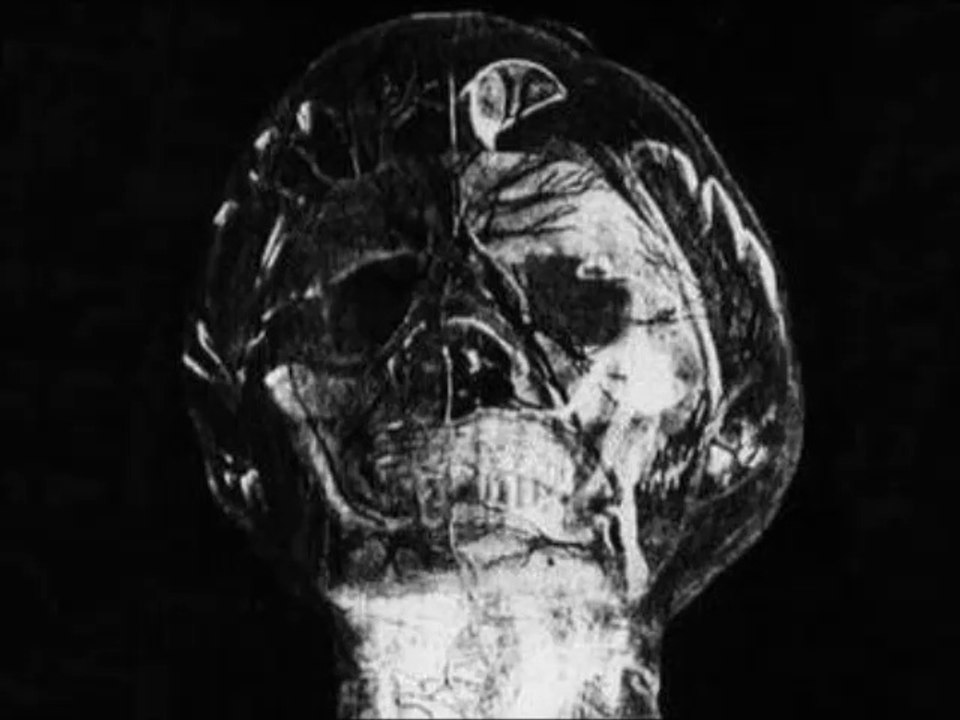 Aktive Stagnation - Kein Lichtreflex