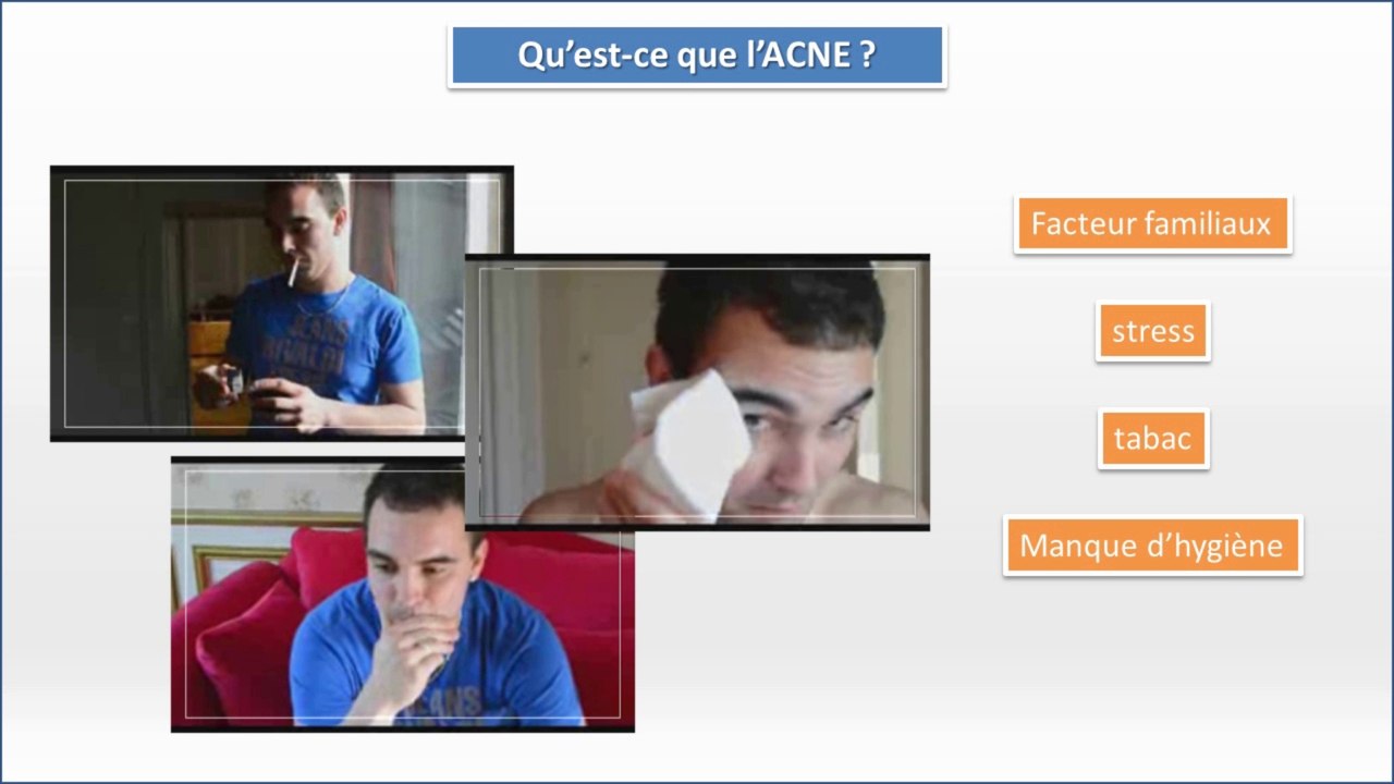 Qu’est-ce que l’acné ?