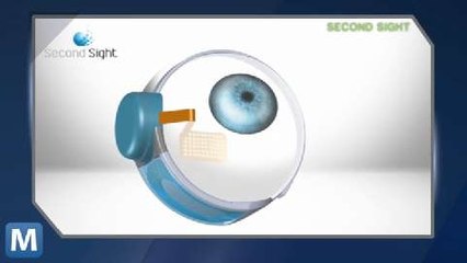 Implants Allows Visually Impaired to See Ordinary Text as Braille