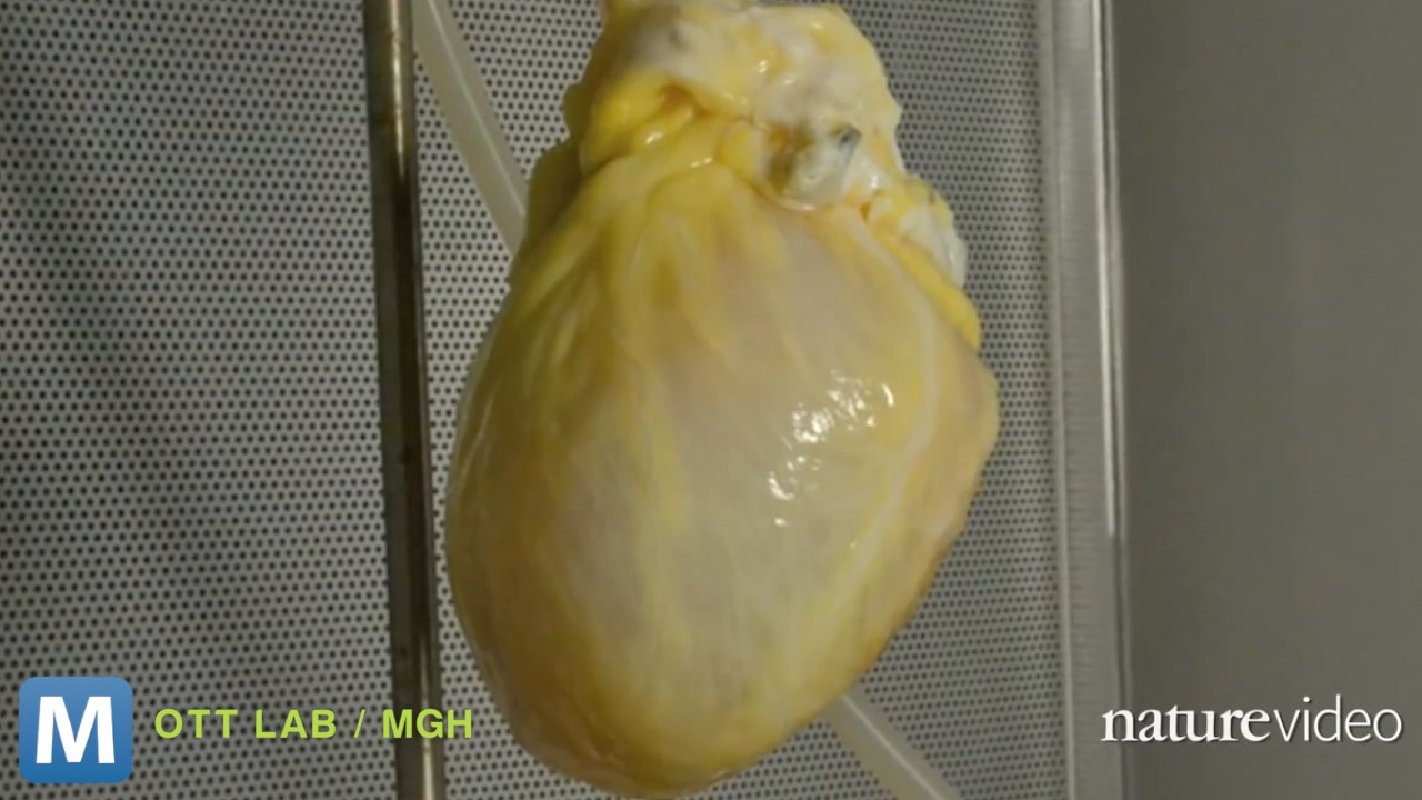 Scientists Want to Build a Heart for Patients i...