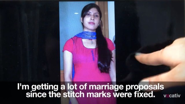 India's Plastic Surgery Spikes in Social Media Users