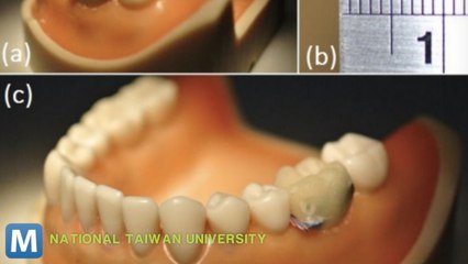 Tooth Sensor Will Warn You If You’re Eating too Much