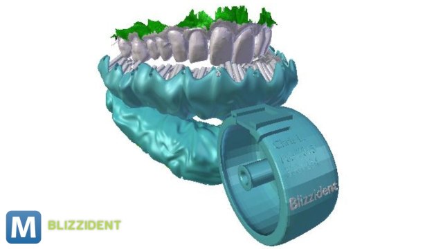 Hybrid ‘Mouthguard’ Toothbrush Cleans Your Mouth in 6 Seconds