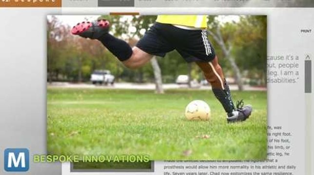 3D-Printed Prosthetics Match Limb to Personality