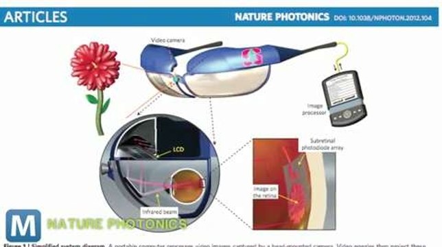 Wireless Retinal Implants Could Help Restore Vision