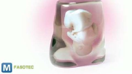 Can’t Wait 9 Months? Print Out a 3D Copy of Your Unborn Child