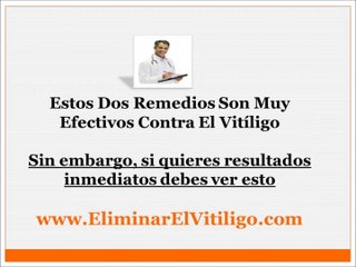 Como Curar Vitiligo En Casa - Ayuda para el vitiligo