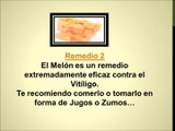 Como Quitar Manchas De Vitiligo - tratar el vitiligo con remedios naturales