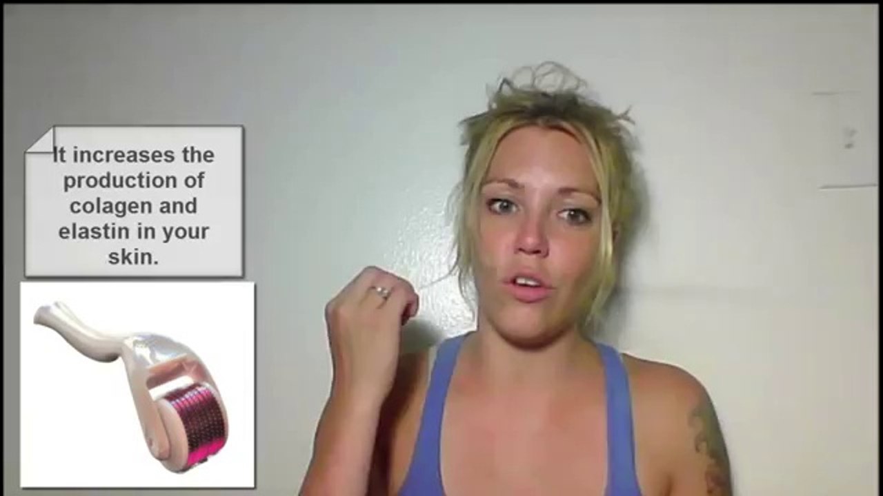 Stretch marks removal tips and tricks 2 – The derma roller trick