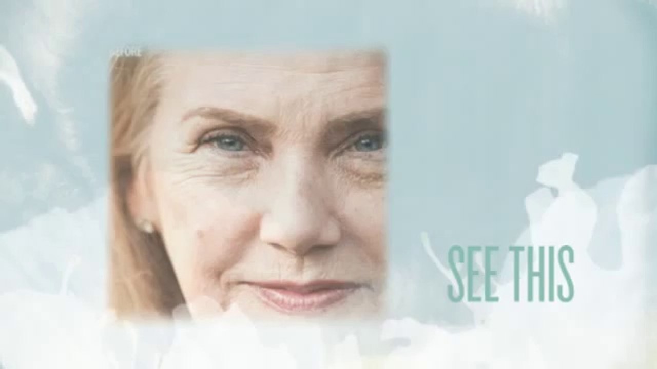 decrease wrinkles gone