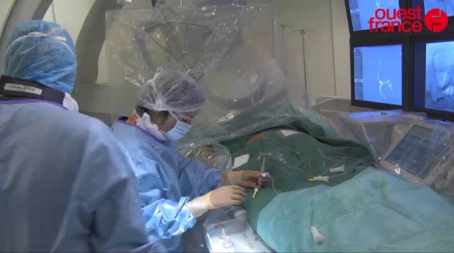 CHU Rennes: nouvelle technique pour soigner les anevrismes