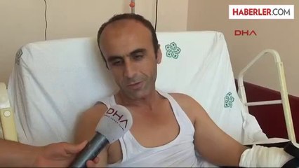 Pres Makinasında Bileğinden Kopan Sol Eli Geri Dikildi