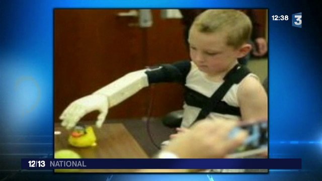 Avec une imprimante 3D, des étudiants créent un bras robotisé pour un enfant de 6 ans