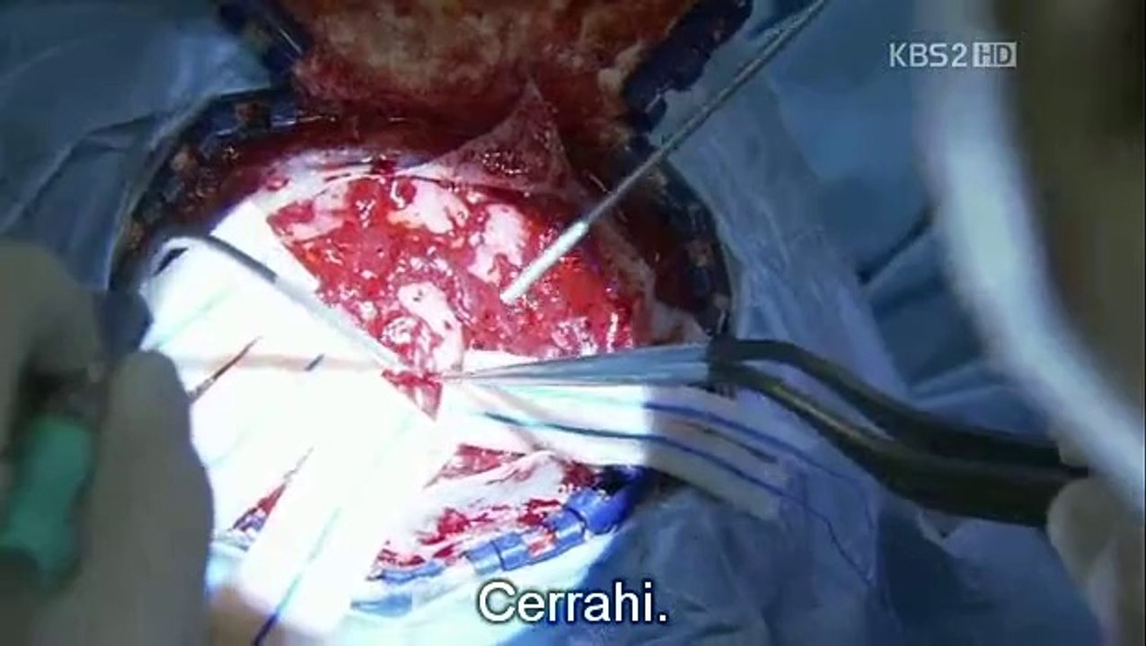 Brain koreanturk (2)_clip0