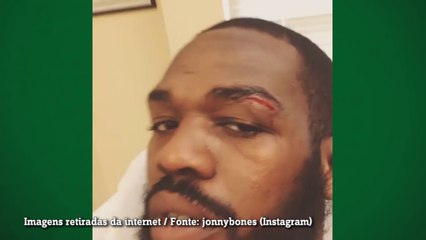 Jon Jones sofre corte profundo e faz vídeo tomando pontos