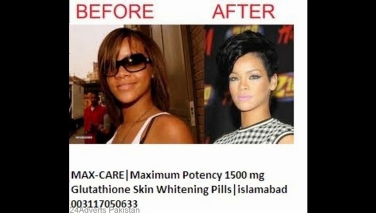 skin-whitening-pills-for-black-skin-glutathion-in-pakistan-karachi-multan-lahore-