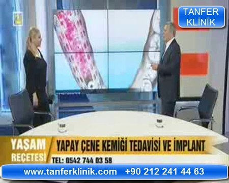 Yapay Çene Kemiği Tedavisi ve implant Nedir?