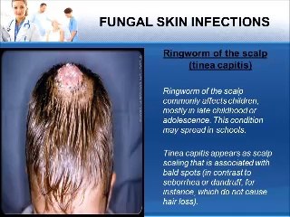 Dr. Brian Swan. COMMON SKIN INFECTIONS. VIDEO