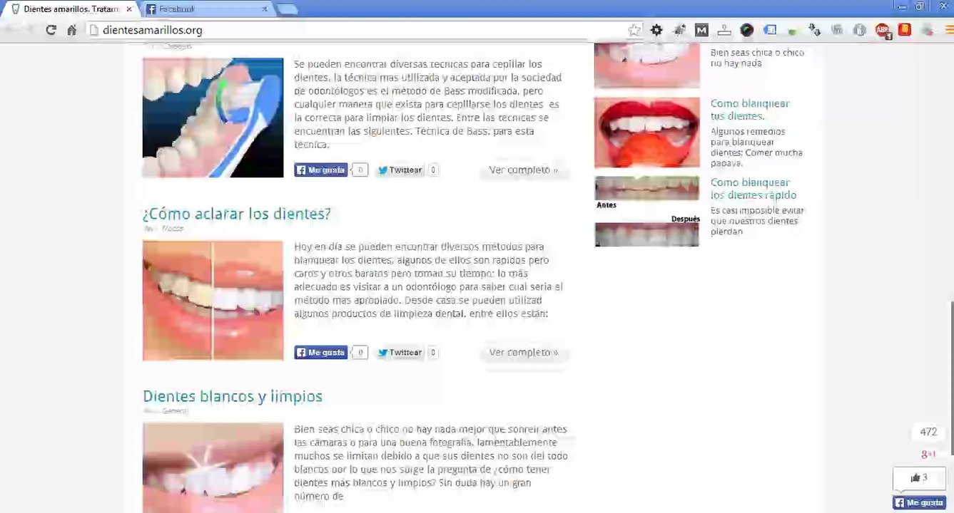 tratamiento para dientes amarillos