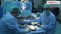 Damar Tıkanıklığı Olan Hastalara Önce Öküz Perikardından Damar Yapılıyor, Sonra Karaciğer Nakli