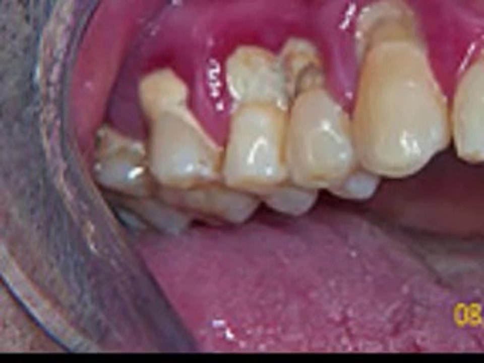 port orange dentist