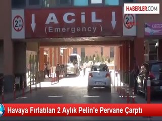 İki Aylık Bebeğin Kafası Pervaneye Çarptı