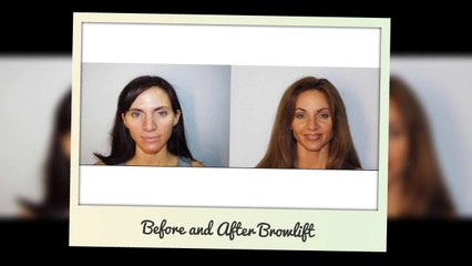 Cosmetic surgeon in Phoenix AZ as well as Scottsdale