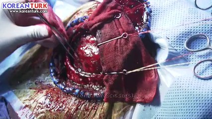 ain.koreanturk (20)_clip0