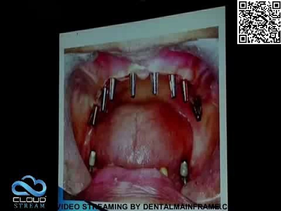 Secunderabad dentists association- inaugural CDE by Dr Sacheev nanda- part 2