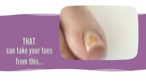 Tea Tree Oil Video - Toenail Fungus