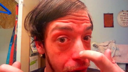 Eradicating some small white pussy pimples, that's all this video is!