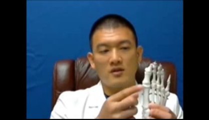 Dr. Kevin Lam Modification Bunionectomy scarlessbunion.com