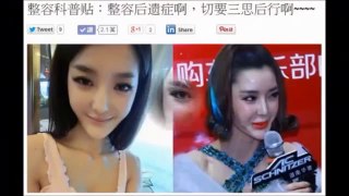 【衝撃】整形にも賞味期限？中国人美人モデルの顔が２年で激変　Telumi0344348600