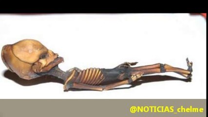 El mini extraterrestre hallado hace 10 años en Chile era un humano mutante (24_04_13)