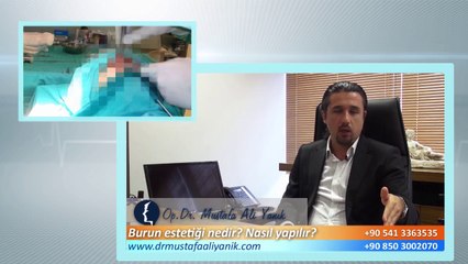 Descargar video: Op. Dr. Mustafa Ali Yanık burun estetiği nedir ve nasıl yapılır ?=