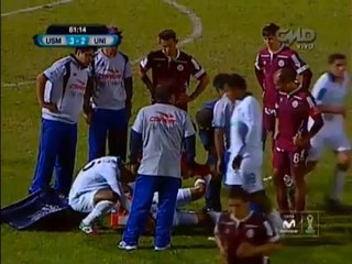 Paolo Bustamante sufre fractura