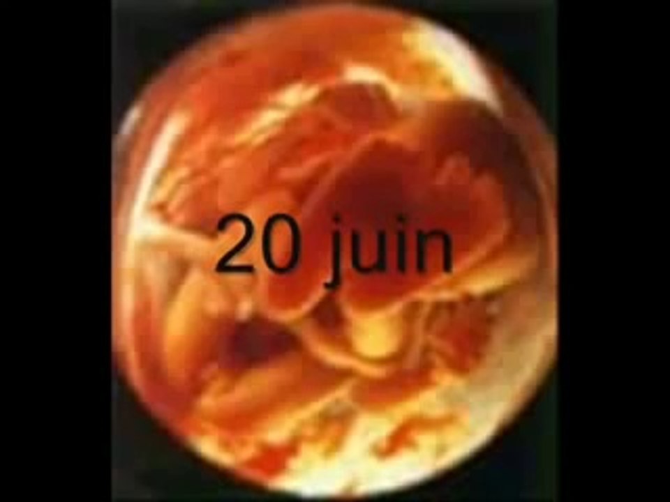 Aujourdhui m'a maman ma fait mourir
